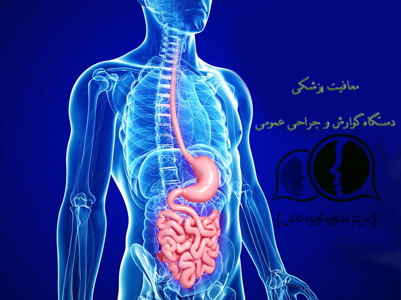 معافیت پزشکی, معافیت دستگاه گوارش, معافیت بیماری گوارشی, معافیت دستگاه گوارش و جراحی های عمومی, مشاوره نظام وظیفه, مشاوره معافیت سربازی, مشاوره معافیت پزشکی