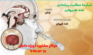 مدارک معافیت پزشکی غدد هیپوفیز,شرایط معافیت پزشکی غدد هیپوفیز,قوانین معافیت پزشکی غدد هیپوفیز,مراحل معافیت پزشکی غدد هیپوفیز,مشاوره معافیت پزشکی غدد هیپوفیز