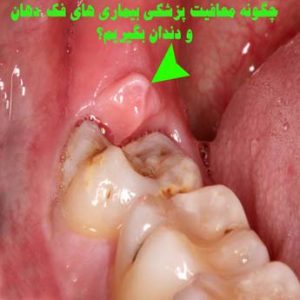 معافیت پزشکی بیماری های فک، دهان و دندان چه مراحلی دارد؟