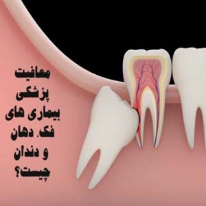 معافیت پزشکی بیماری های فک، دهان و دندان چه معایبی دارد؟