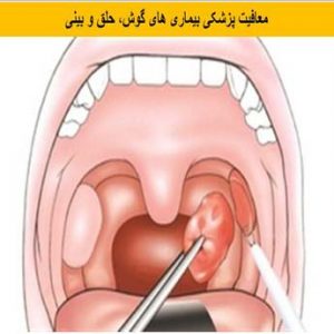 چگونه معافیت پزشکی گوش، حلق و بینی بگیریم؟