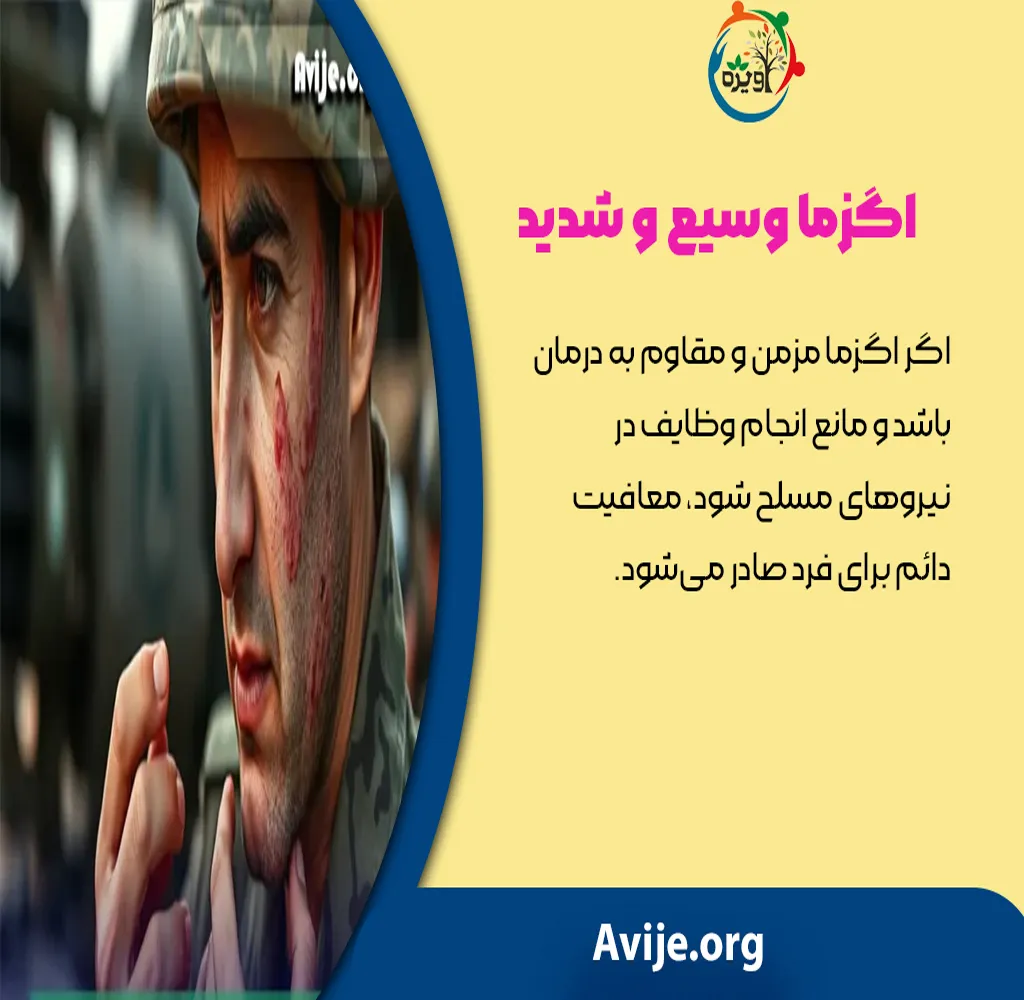 معافیت پزشکی بیماری اگزما