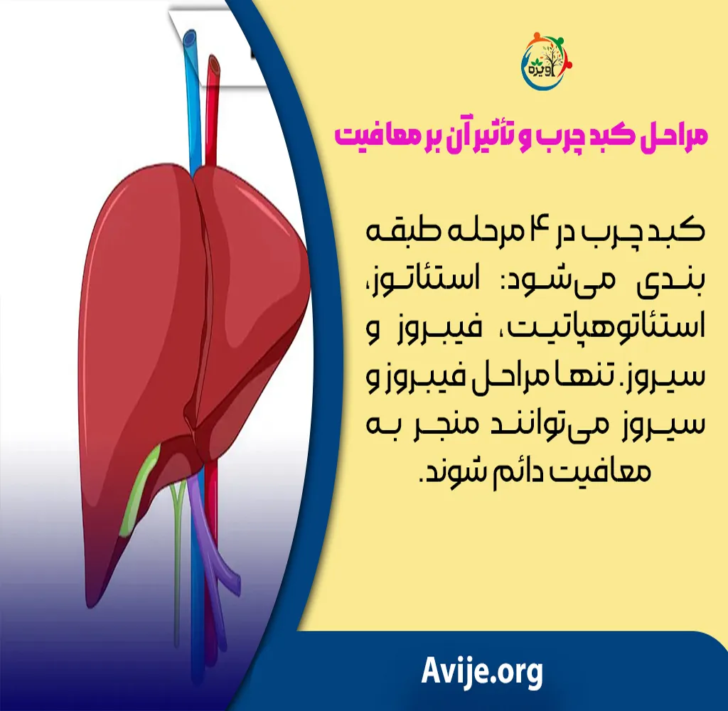 معافیت پزشکی کبد چرب