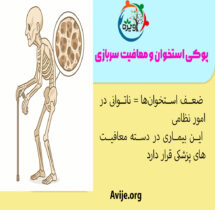 معافیت پوکی استخوان