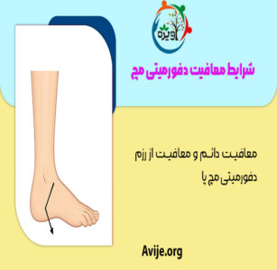 معافیت دفورمیتی مچ پا
