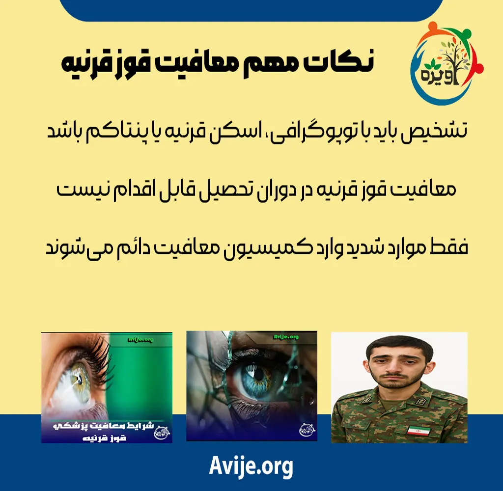 مراحل دریافت معافیت پزشکی قوز قرنیه